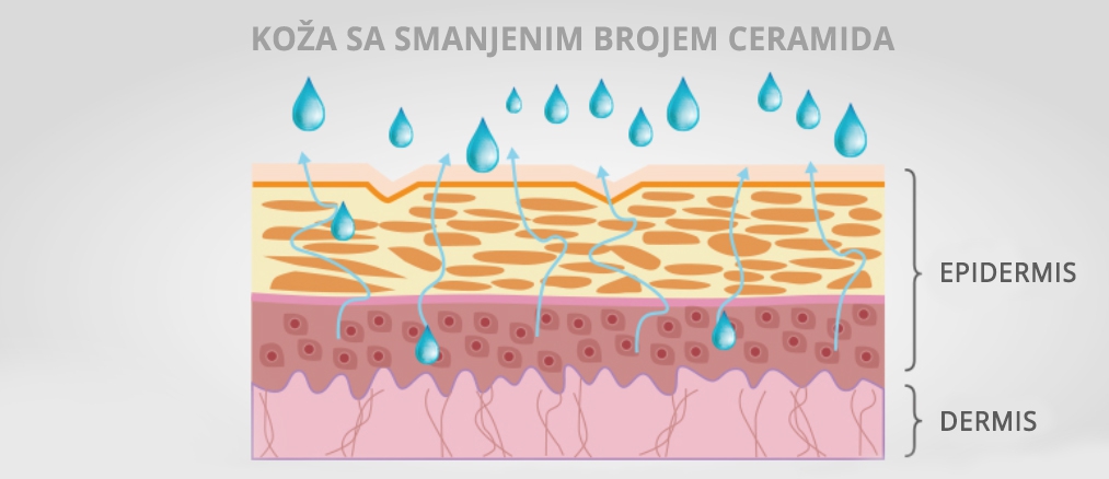 Koža sa smanjenim brojem ceramida