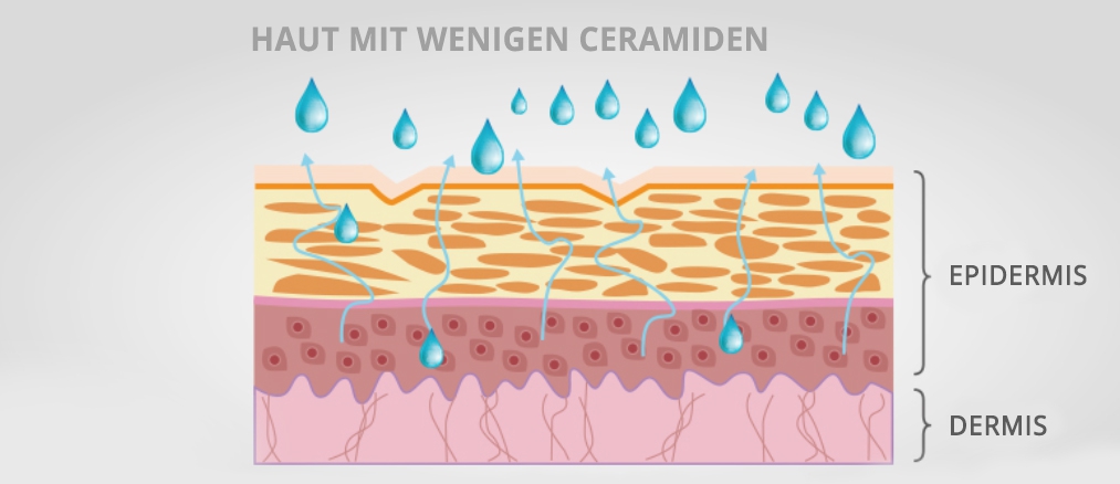 Ceramide